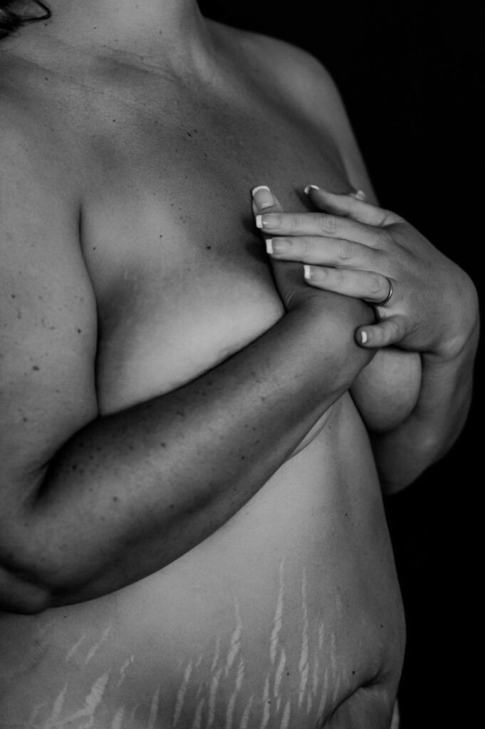 Black and white photo of a person’s upper body, with hands covering their chest. Stretch marks are visible on the lower abdomen. This Nashville boudoir image highlights natural skin texture and celebrates body positivity.