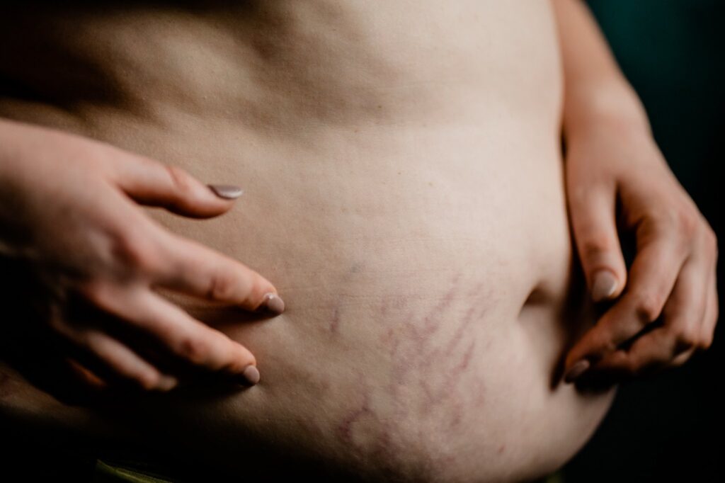 A close-up of a person's bare stomach with visible stretch marks, softly lit as their hands gently touch their abdomen—capturing natural beauty in the signature style of a Nashville creative portrait photographer.