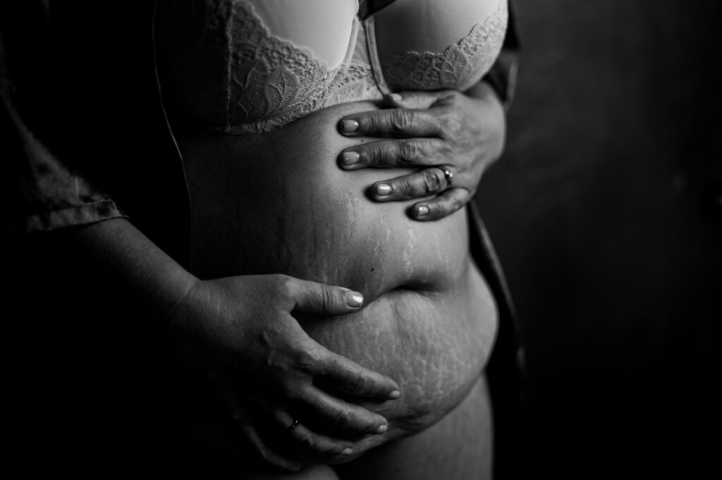A black and white boudoir photo of a person wearing a bra, gently holding their stomach with both hands, showing visible stretch marks and textured skin. The lighting creates a soft, intimate mood, subtly capturing them looking sexy and confident.